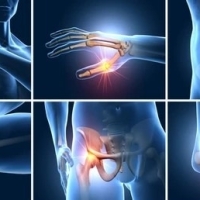 Arthrovit